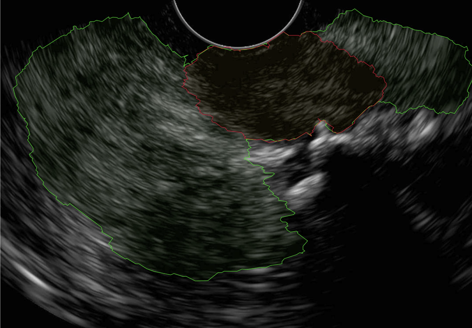 EUS-ML — add project image