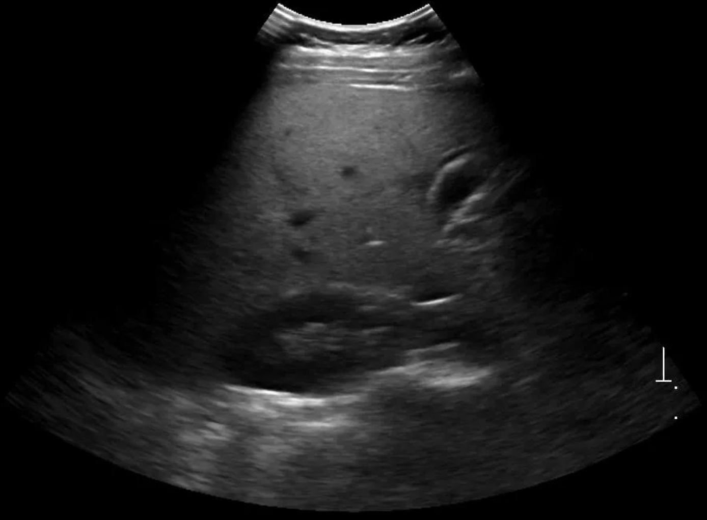 Fatty-Liver Diagnosis — add project image