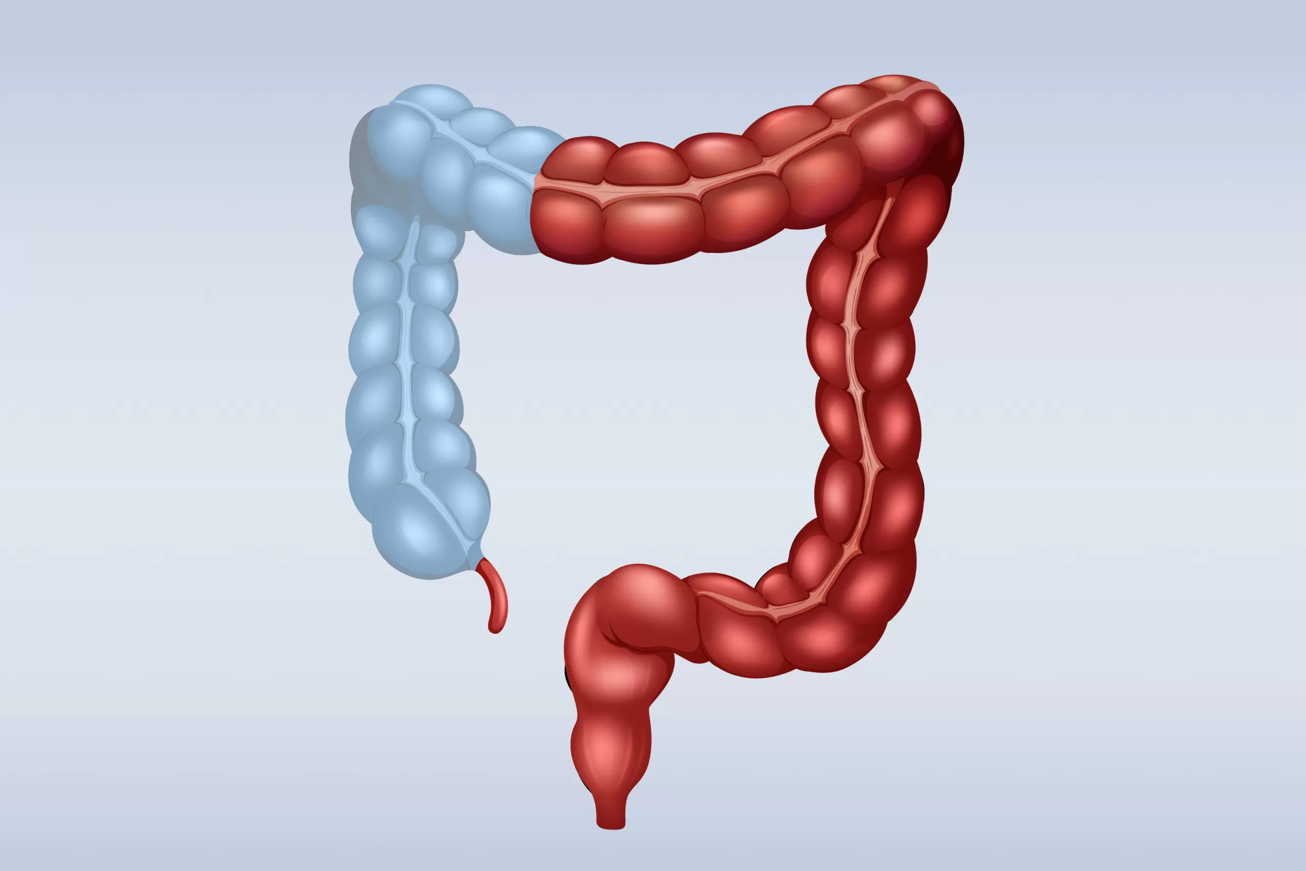Ulcerative Colitis Diagnosis — add project image
