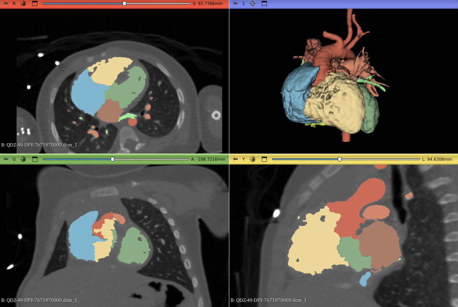 VR-Heart — add project image